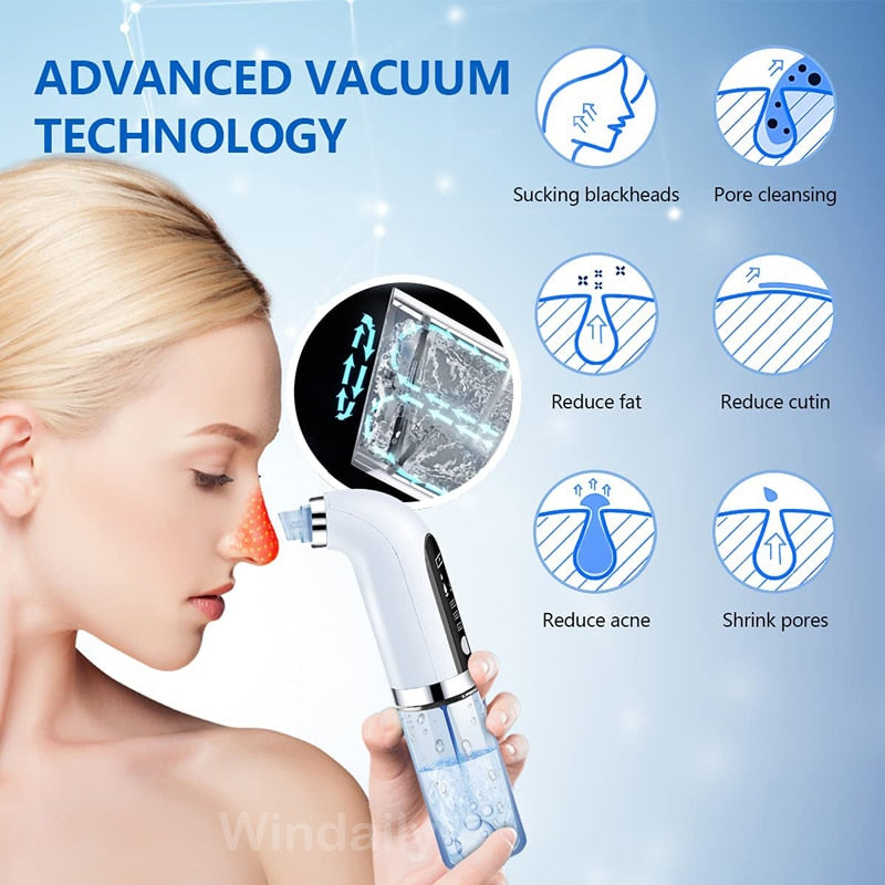 Blackhead/Pore Suction Remover